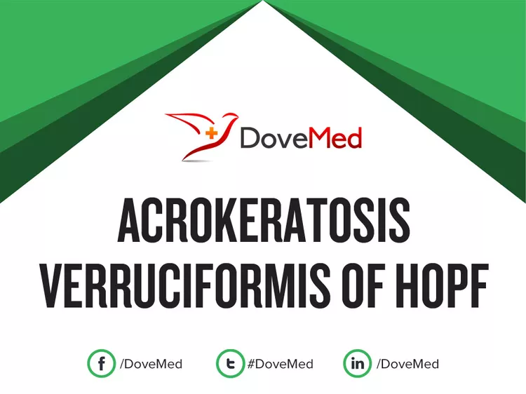 Acrokeratosis Verruciformis Of Hopf Dovemed