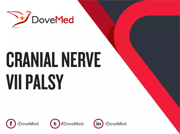 Cranial Nerve Vii Palsy Dovemed