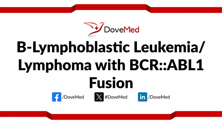 B Lymphoblastic Leukemia Lymphoma With BCR ABL1 Fusion DoveMed