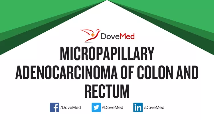 Micropapillary Adenocarcinoma Of Colon And Rectum DoveMed