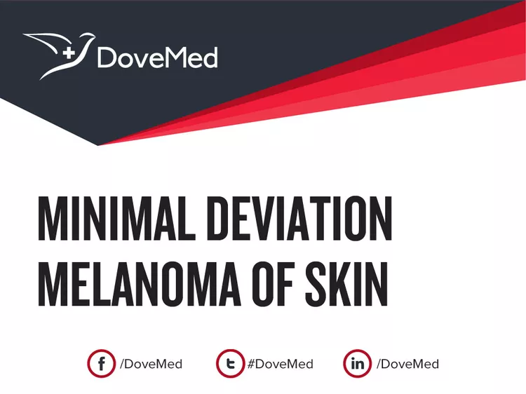 Minimal Deviation Melanoma Of Skin DoveMed