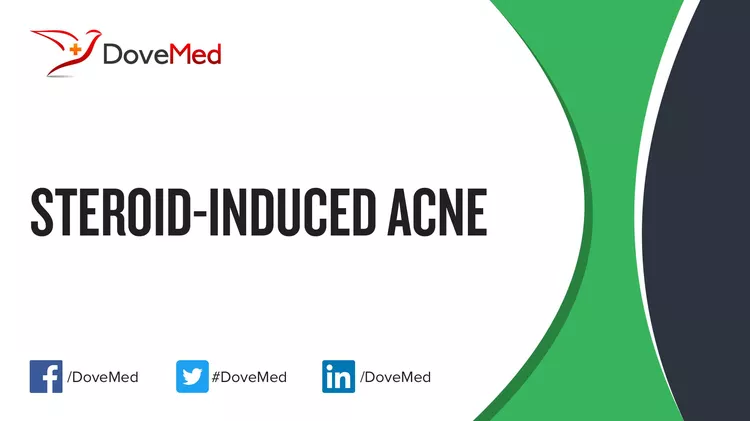 Steroid Induced Acne Dovemed