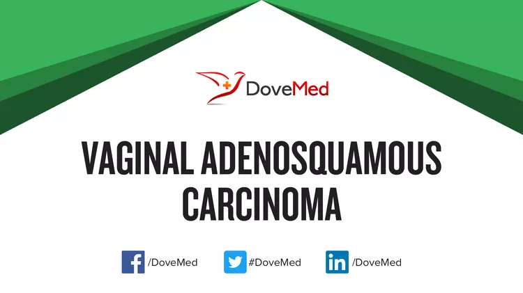 Vaginal Adenosquamous Carcinoma Dovemed