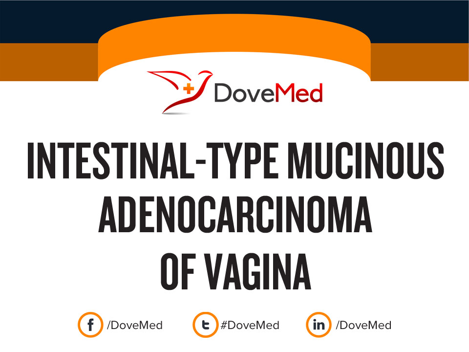 Intestinal Type Mucinous Adenocarcinoma Of Vagina