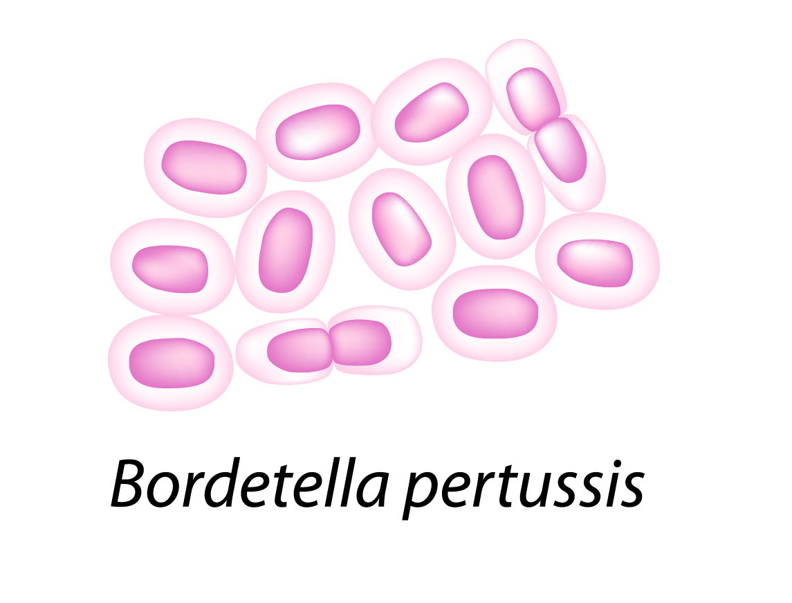 Bordetella pertussis parapertussis. Возбудитель коклюша Bordetella pertussis. Bordetella пертуссис. Bordetella pertussis микробиология. Возбудитель коклюша рисунок микробиология.