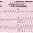 Rhythm Generated of the heart.
