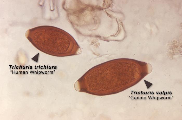 whipworm larvae