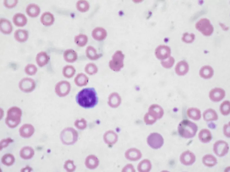 Peripheral Blood Smear Examination - DoveMed