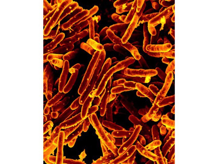 TB Screening Test - Interferon-gamma Release Assays (QuantiFERON Test)