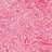 Microscopic pathology image showing Pleomorphic Fibroma.