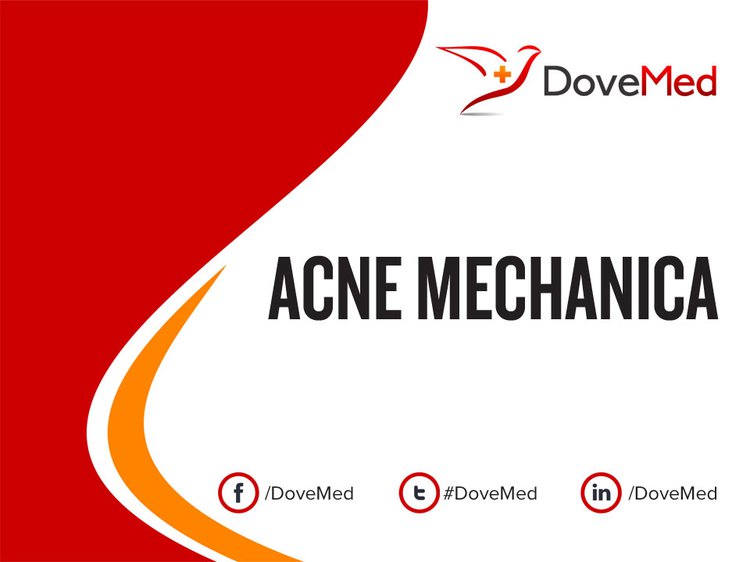 Acne Mechanica