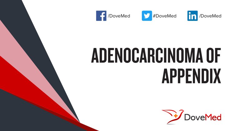 adenocarcinoma-of-appendix