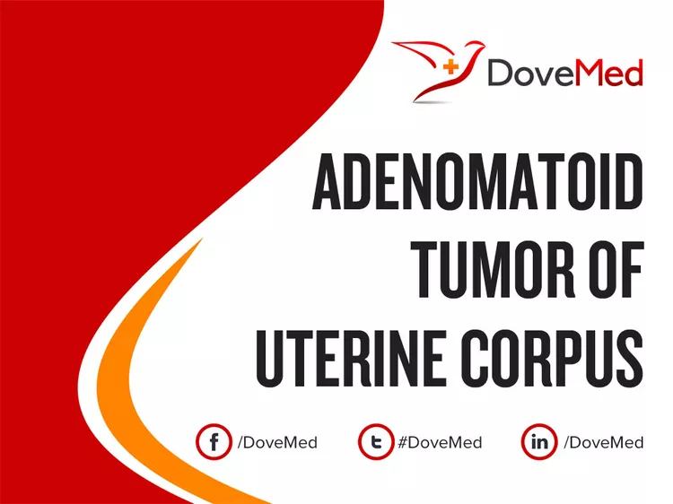 Adenomatoid Tumor Of Uterine Corpus Dovemed