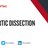 Aortic Dissection.