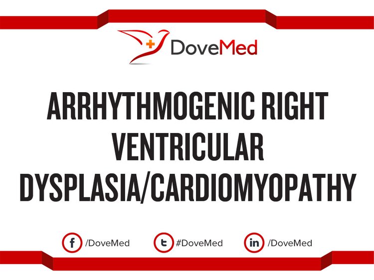 Arrhythmogenic Right Ventricular Dysplasia/Cardiomyopathy (ARVD/C)