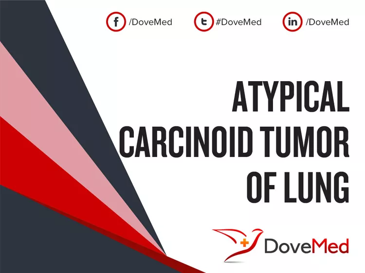 atypical carcinoid lung tumor icd 10