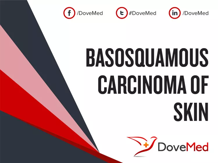 Basosquamous Carcinoma Of Skin Dovemed