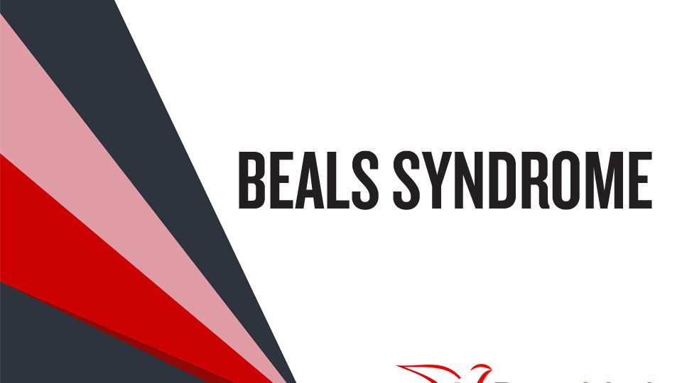 How well do you know Beals Syndrome?