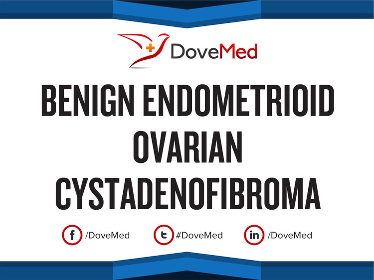 Benign Endometrioid Ovarian Cystadenofibroma