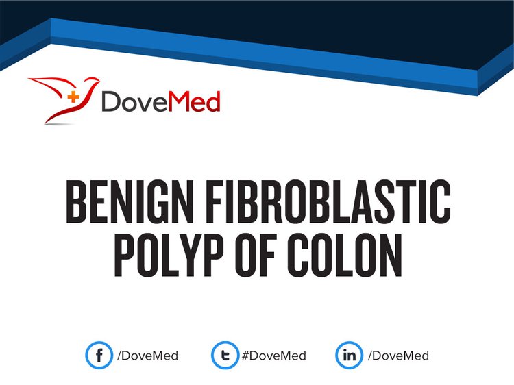 icd 10 benign colon polyp