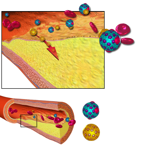 A Spring-loaded Sensor For Cholesterol In Cells