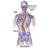 Scoliosis.