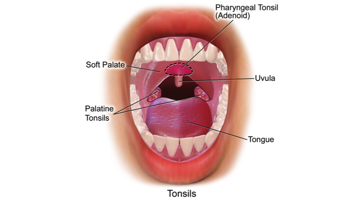 How much does tonsil removal cost