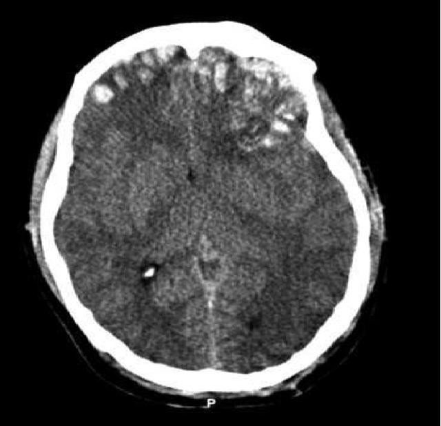 Brain Imaging Reveals Adhd As >> Brain Imaging Reveals Adhd As A Collection Of Different Disorders Brain Imaging Reveals Adhd As >> Brain Imaging Reveals Adhd As A Collection Of Different Disorders