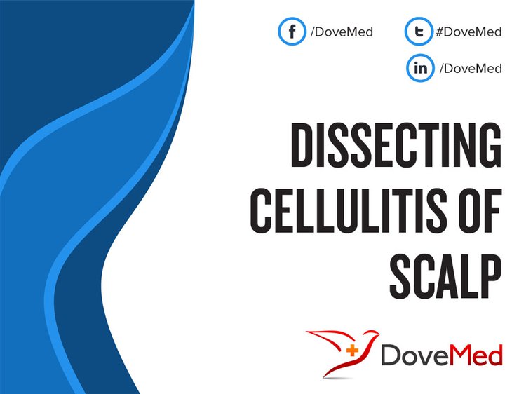 What are the other Names for this Condition? (Also known as/Synonyms). DCS (Dissecting Cellulitis ...