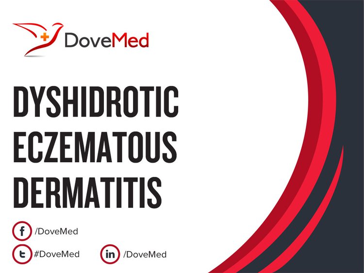 Dyshidrotic Eczematous Dermatitis