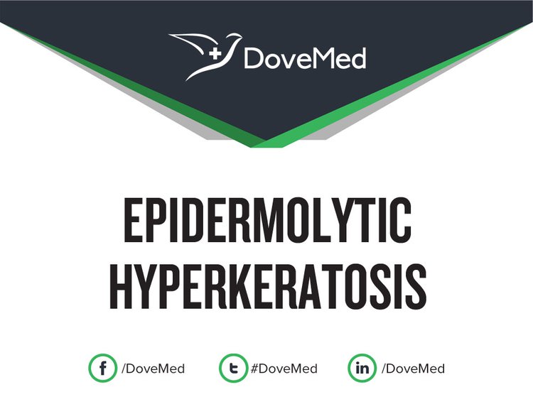 Epidermolytic Hyperkeratosis (EHK)