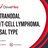 Extranodal NK_T-Cell Lymphoma, Nasal type.