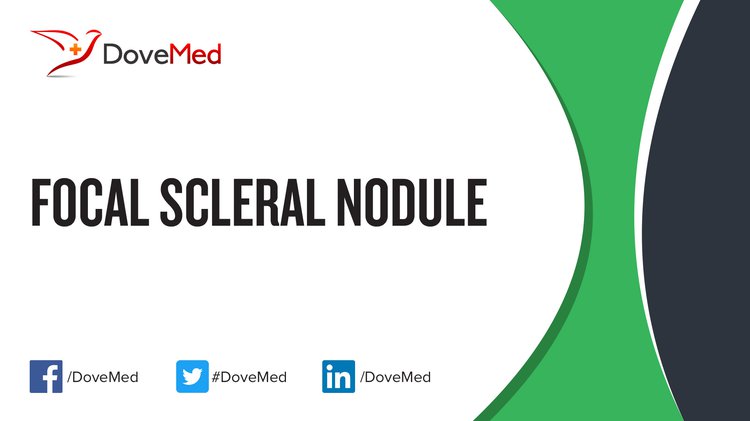 focal-scleral-nodule