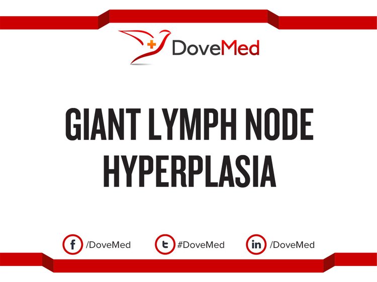 giant-lymph-node-hyperplasia