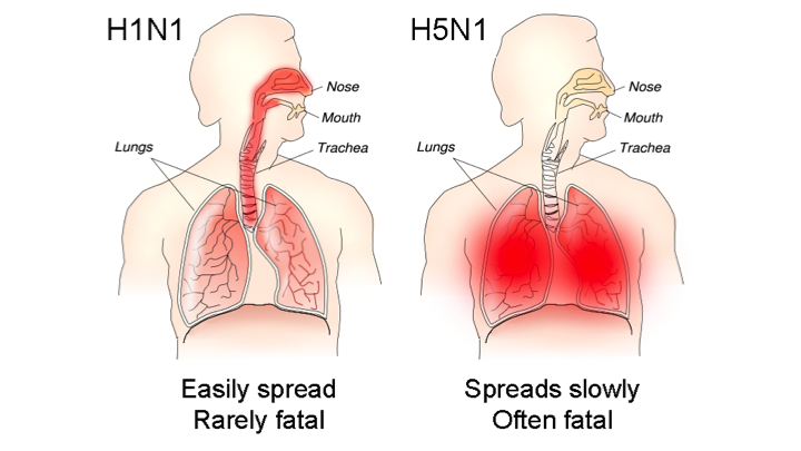 Avian Influenza