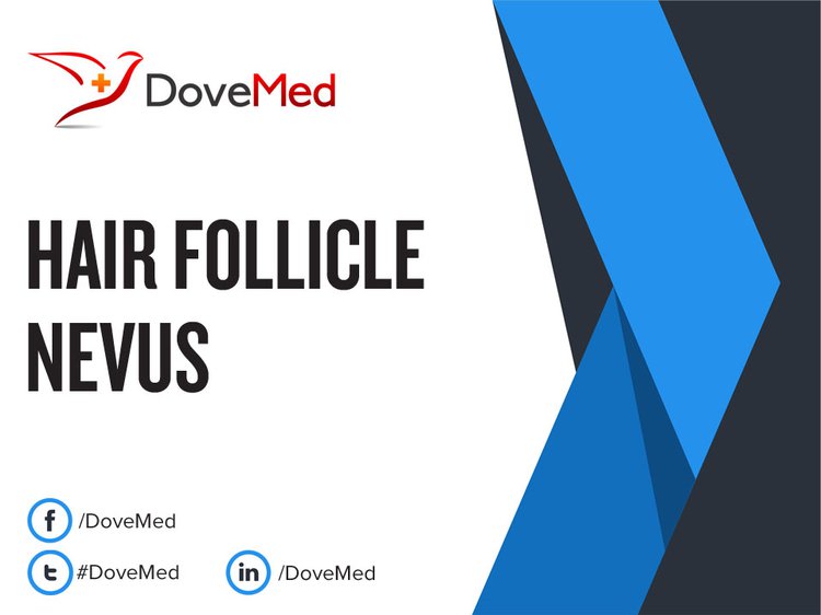 Follicle nevus - wide 7