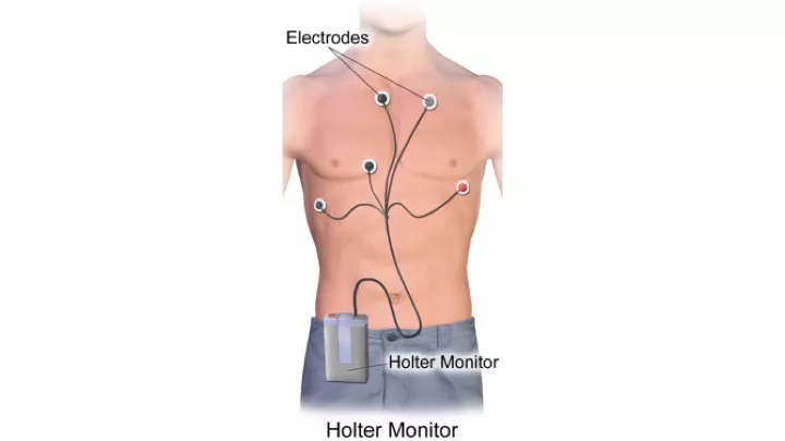 Holter Monitoring - DoveMed