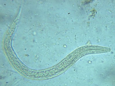 New Treatment For Human Parasitic Worm Infections Shows High Efficacy