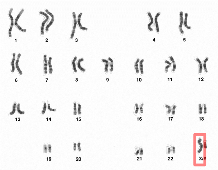X Chromosome Reactivation Could Treat Rett Syndrome Other X Linked