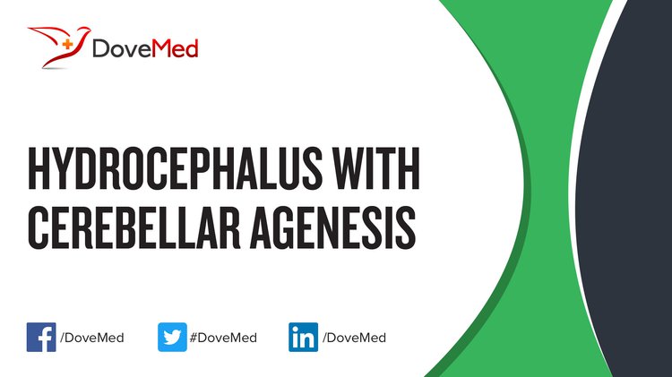 Hydrocephaly-Cerebellar Agenesis Syndrome