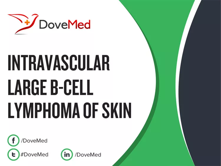 Intravascular Large B-Cell Lymphoma - DoveMed