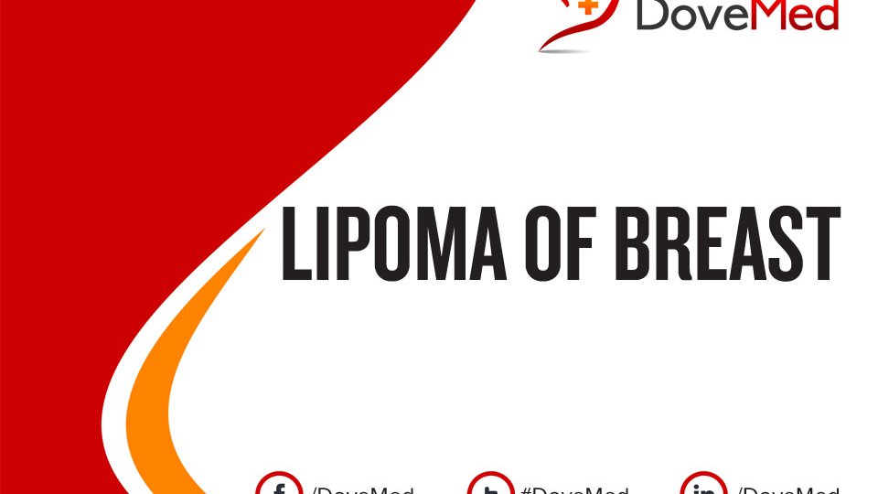 How well do you know Lipoma of Breast?