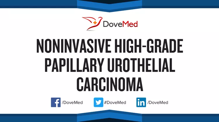 noninvasive-high-grade-papillary-urothelial-carcinoma-dovemed