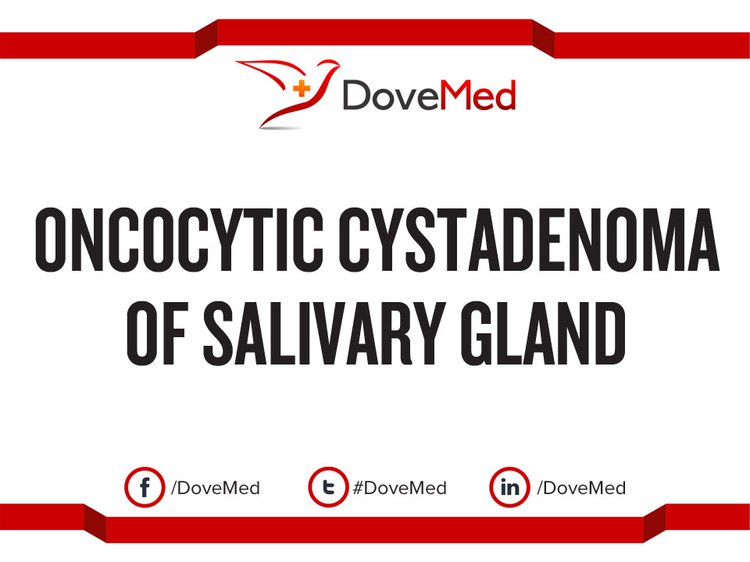 Oncocytic Cystadenoma of Salivary Gland