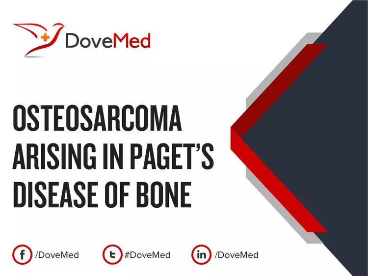 Osteosarcoma arising in Paget's Disease of Bone - DoveMed