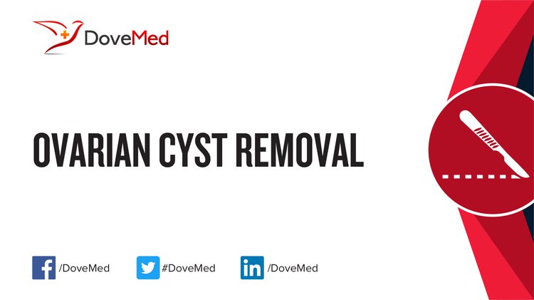 ovarian-cyst-removal