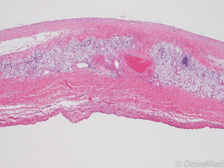 pericardium histology