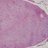 Microscopic pathology image showing benign adrenal gland.