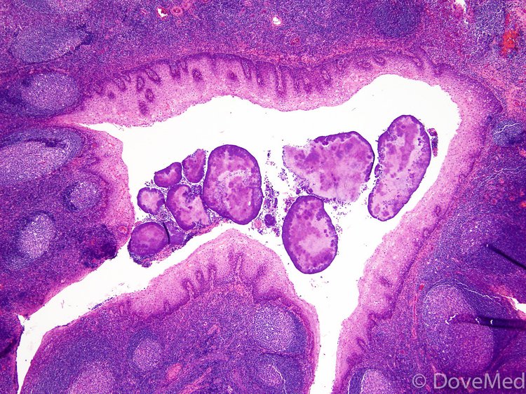 Commensal Bacteria Regulate Immune Cells In Lungs To Produce Proteins ...