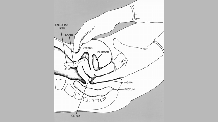 pelvic-examination